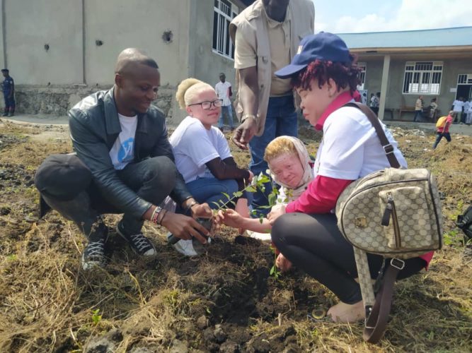 Albinos, peuples indigènes et personnes vivant avec handicap face aux effets du changement climatique